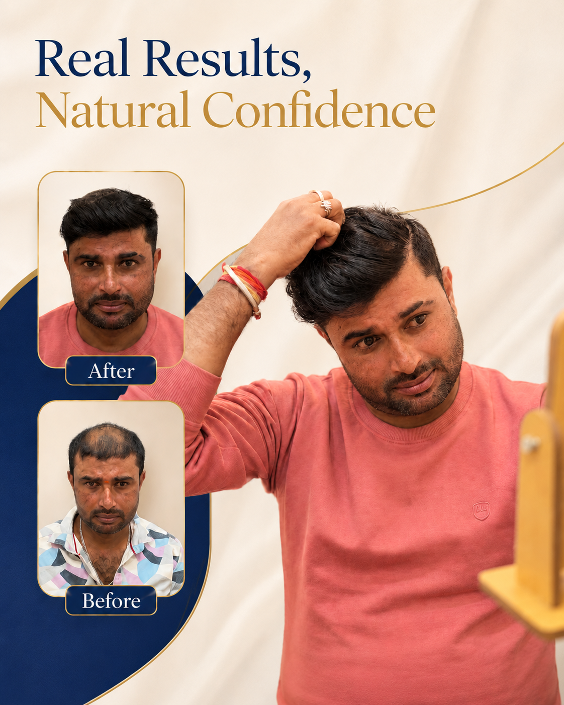 AHIS Aesthetics hair transplant patient showing real results and natural confidence